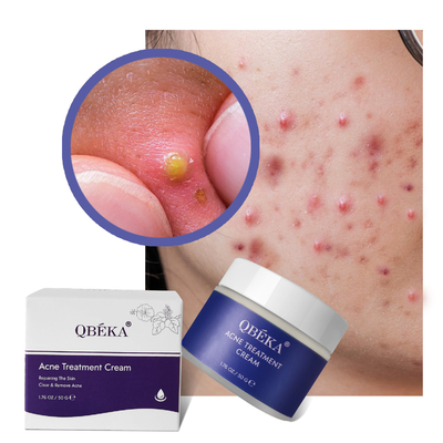 Customized Logo Pimple Cream Lightening Whitening with Hyaluronic Acid Ingredient