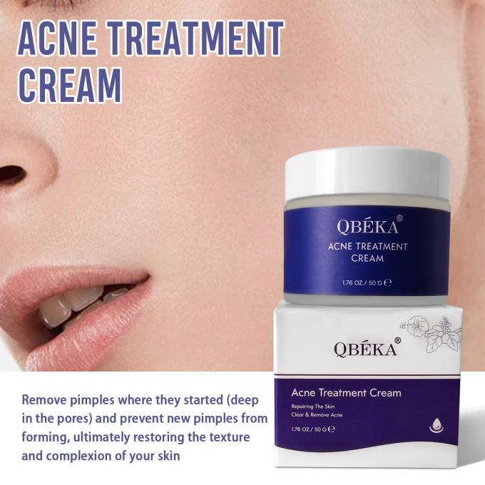 Lightening and Repairing Acne Scars Natural Organic Acne Treatment Cream Quantity 1000 2