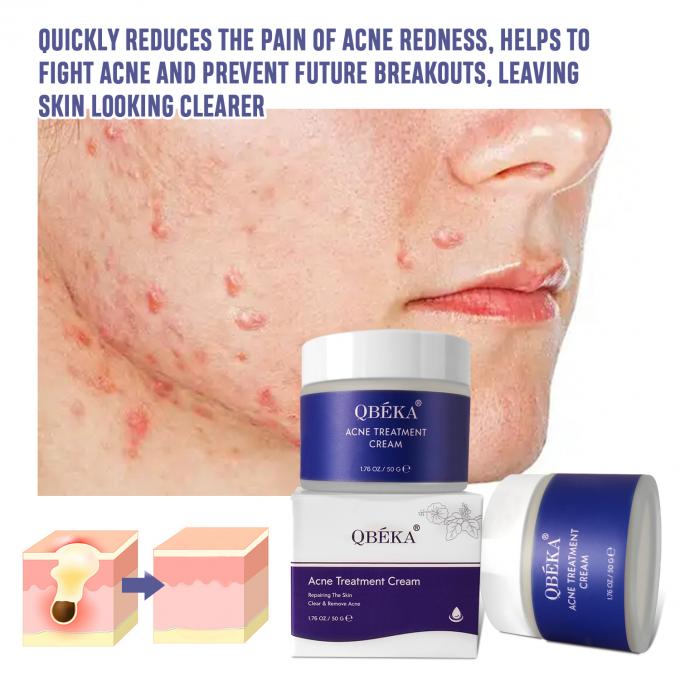 Lightening and Repairing Acne Scars Natural Organic Acne Treatment Cream Quantity 1000 5