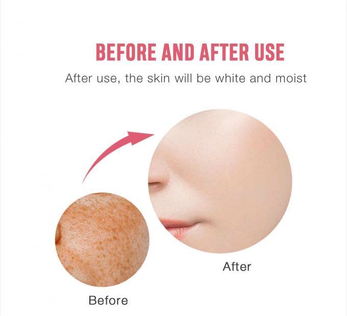 Retinol Facial Cream for Freckle Removal Customized Fragrance and Private Label Offered 7