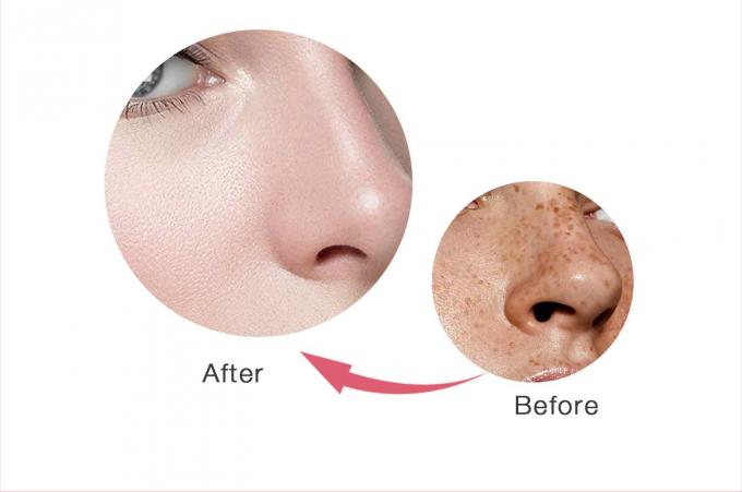 Retinol Facial Cream for Freckle Removal Customized Fragrance and Private Label Offered 8
