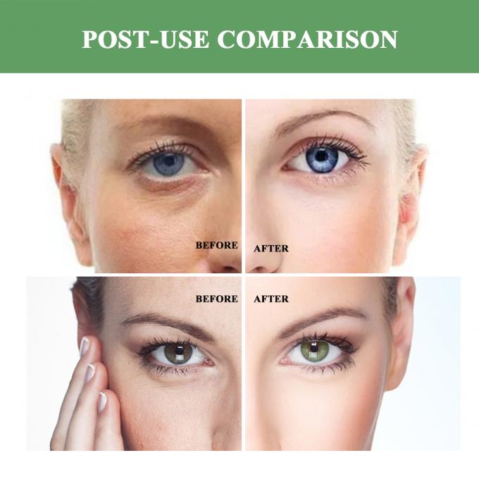 Regular Size Anti Aging Moisturizer Organic Natural Wrinkle Lifting Cream for Adults 7