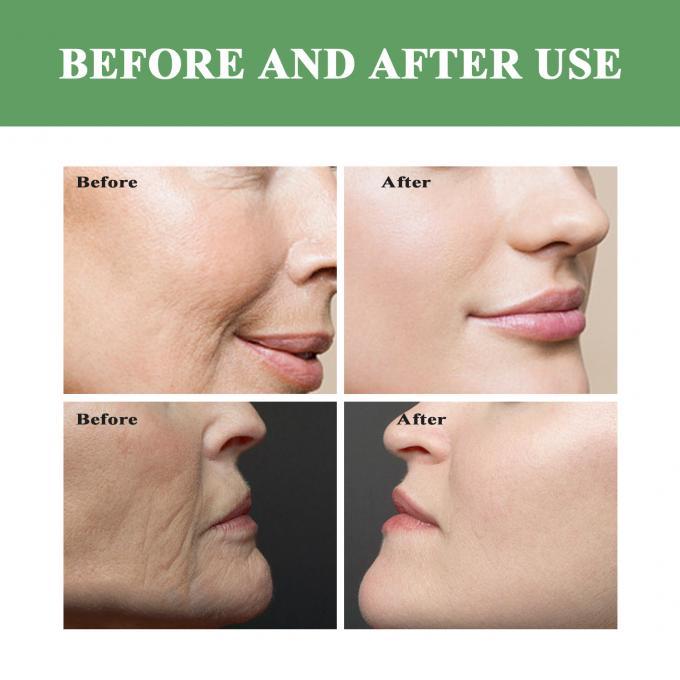 Anti Acne Wrinkle Lifting Youth Toner Private Label Skin Care Water Toner for Women 9