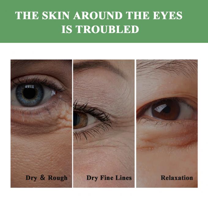 Beauty Eye Cream for Anti-Aging Remove Wrinkles and Tighten Firming OEM/ODM Acceptable 8