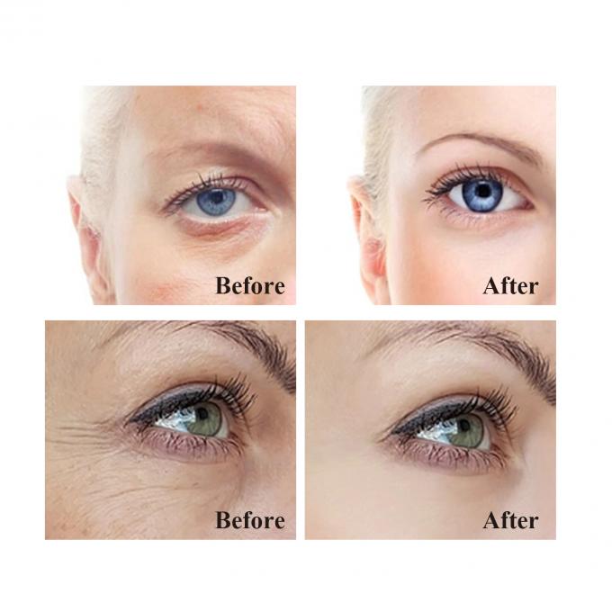Beauty Eye Cream for Anti-Aging Remove Wrinkles and Tighten Firming OEM/ODM Acceptable 9