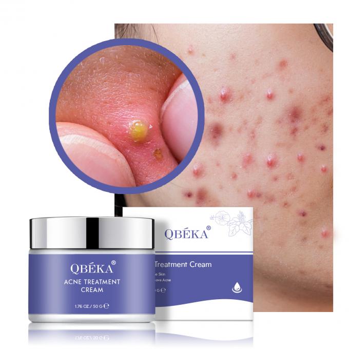 Get Rid of Acne Marks with Our Effective Pigmentation Correctors Dark Spot Treatment 0