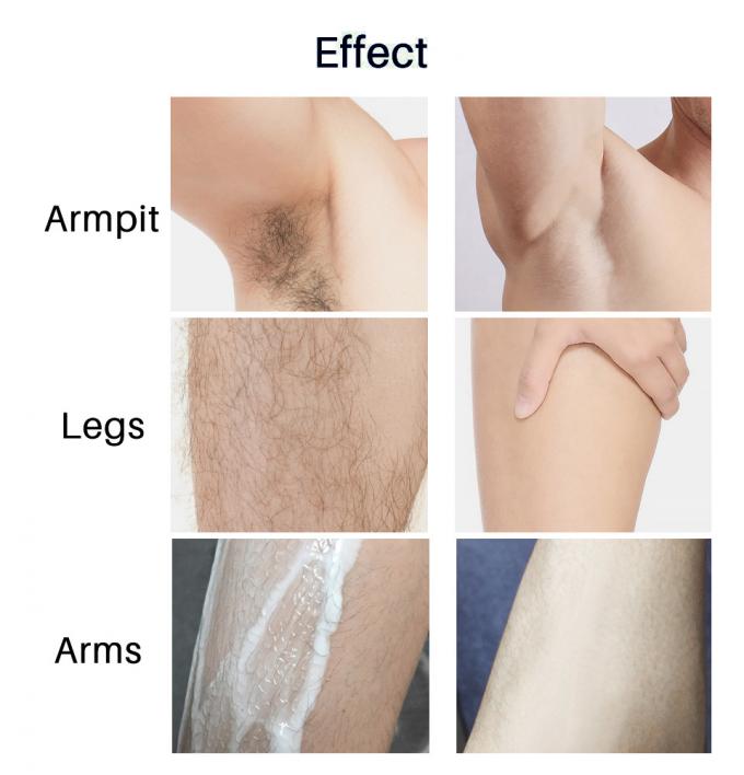 Gentle Hair Removal for Private Parts Armpits Legs and Arms No Irritation or Redness 6
