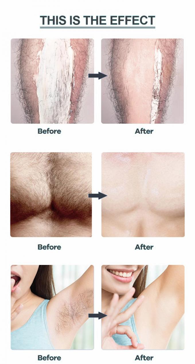 Gentle Hair Removal for Private Parts Armpits Legs and Arms No Irritation or Redness 10