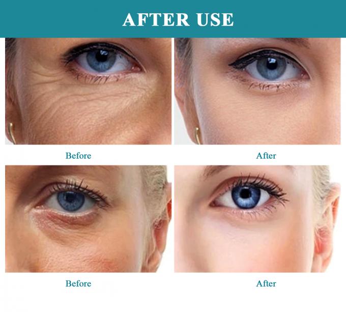 Multi-Effect Moisture and Oil Serum The Ultimate Skincare Solution for Regular Size 5