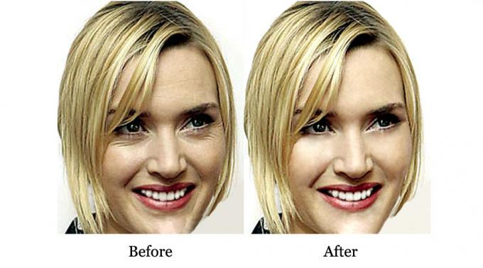 Advantage of QBEKA Protein Peptide Serum Water Retention and Acne Scar Repair 10ml 7