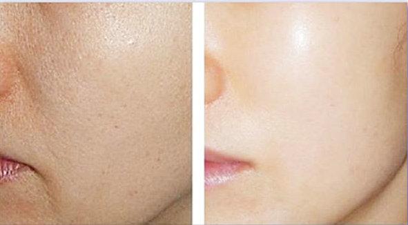 Collagen Overnight Wrinkle Free Face Sheet 40g Jumbo Size 1000boxes High Availability 4