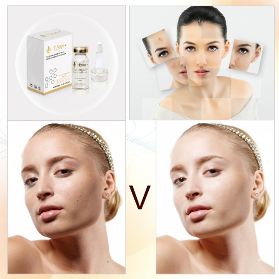 Regular Size Organic Vitamin C Purifying Whitening Anti Freckles Ampoules Quantity 1000 1