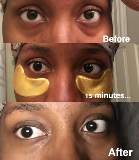 Hydrating Gold Eye Mask for Reducing Fine Lines and Wrinkles Professional QC Team 6